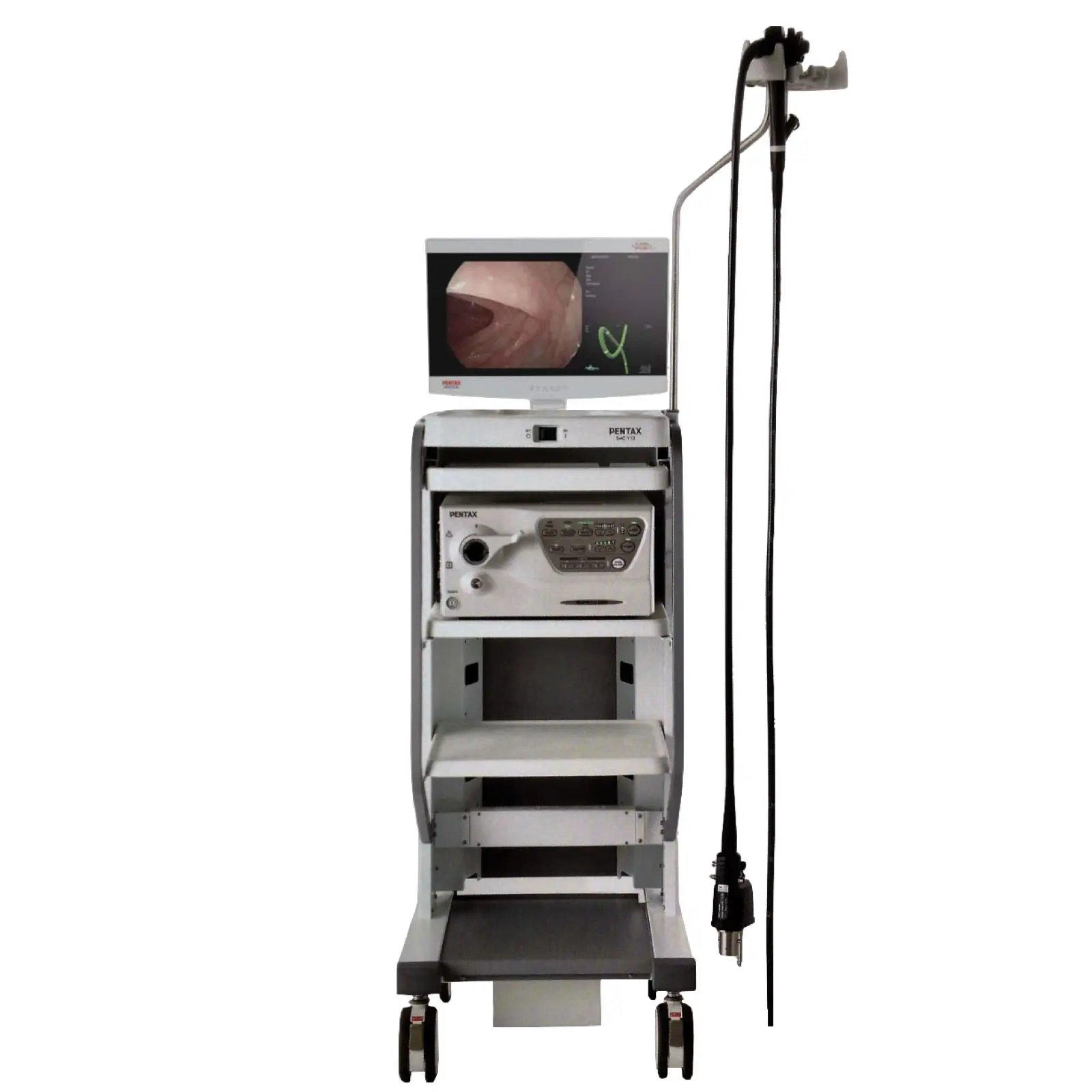 Philips Achieva 1.5T